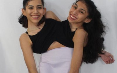 Conjoined Twin Lupita Andrade Shares One Way She Distracts Herself When Sister Carmen Is Getting Intimate
