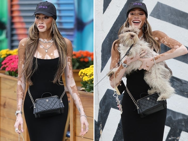 0a4291f656944065b66f5b881703cbf7_md Winnie Harlow Looking Hot On The Streets Of Miami