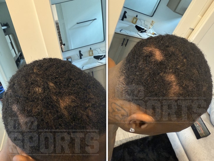 12aca731e3d349e2b49a1ca16b849167_md-1 xavier worth dreads ripped out lawsuit 1
