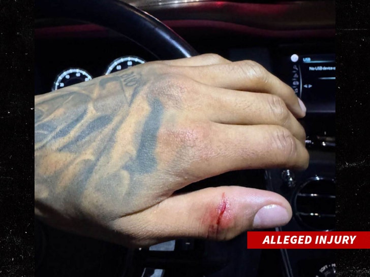ddg-hand-injury-2