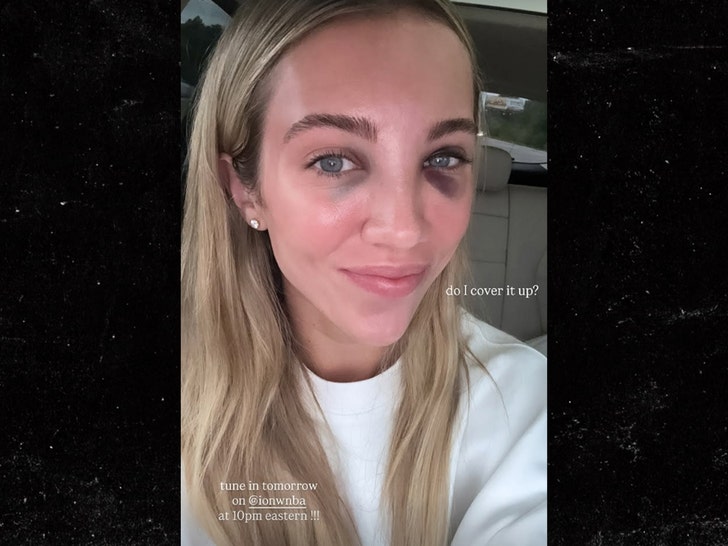 Lexie Hull injury 1