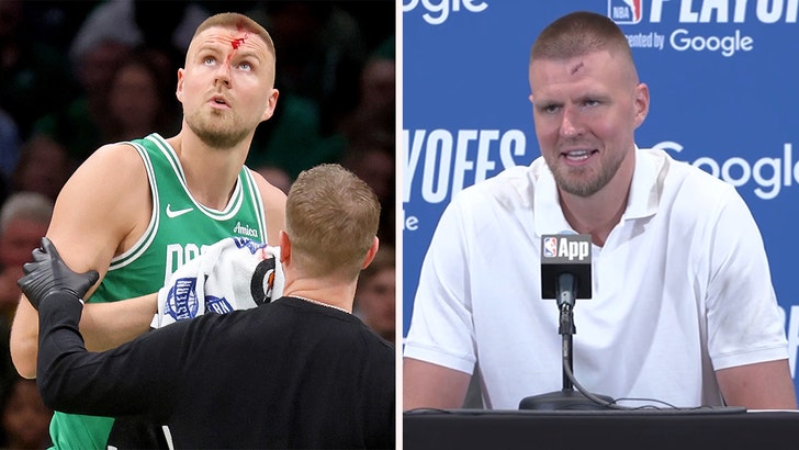 kristap-porzingis-injury-to-head-getty-nba-1