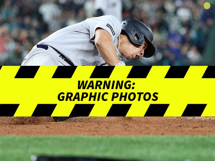 2f624f4a32104e5eb19fafced7693404_md Oswaldo Cabrera's Gruesome Leg Injury At Home Plate