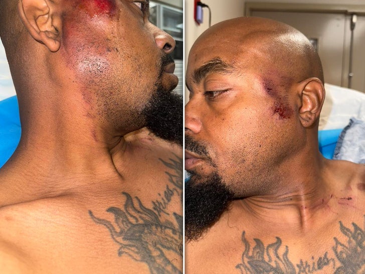 30b2af5f36994782b2603deba26280c6_md repo man injuries sub facebook