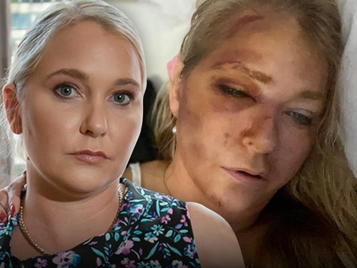 Virginia Giuffre injuries