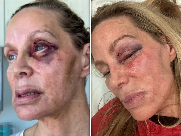 358ac623d83c4d20bda59c6d087b708a_md-2 christina fulton injuries handout