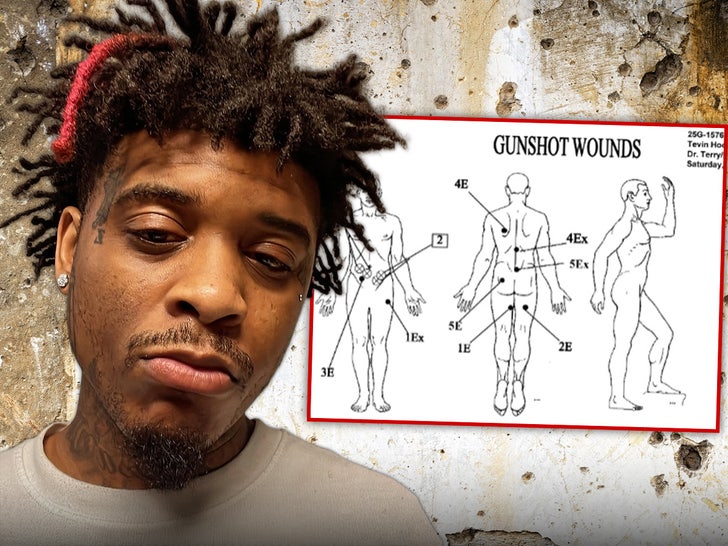 t hood gunshot wounds main getty composite