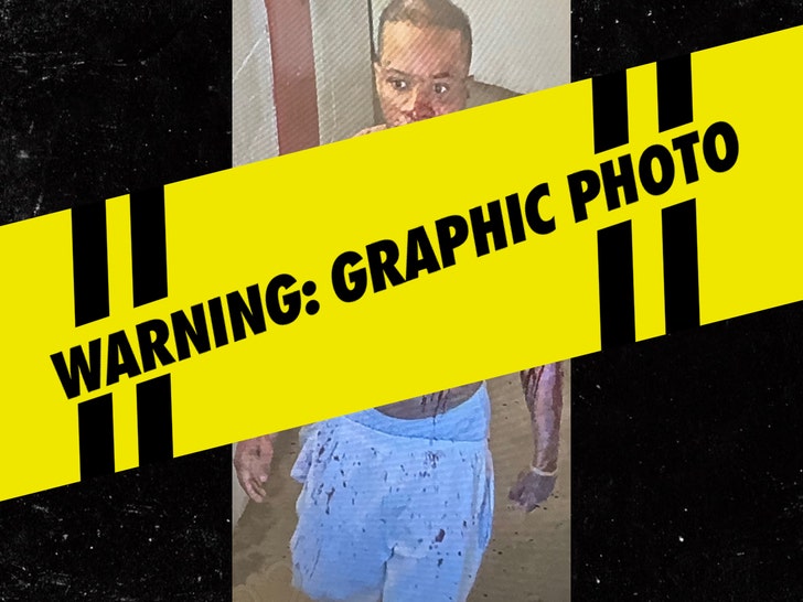 3f03a4dd78d542579a076448cbded9ac_md-1 Tory Lanez Gruesome Photo