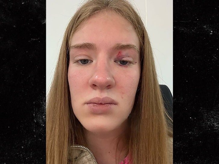 44277d1a4ca649dc81fd918276200508_md lady bit by giant fish injury 1