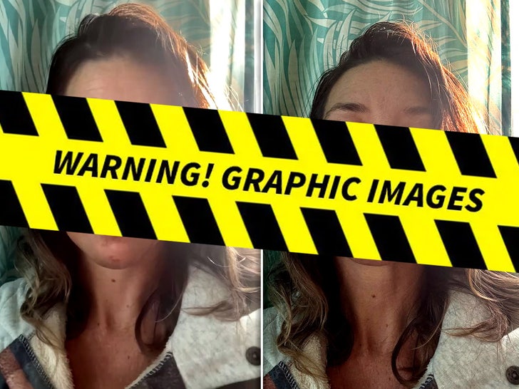 45eddea4d91c461da2173dcf95e1036a_md Evangeline Lilly's Fall Injury