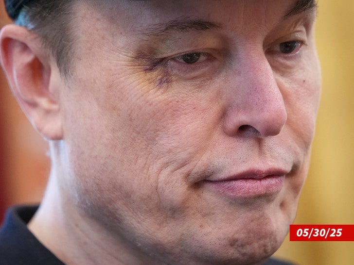elon musk black eye white house getty 2
