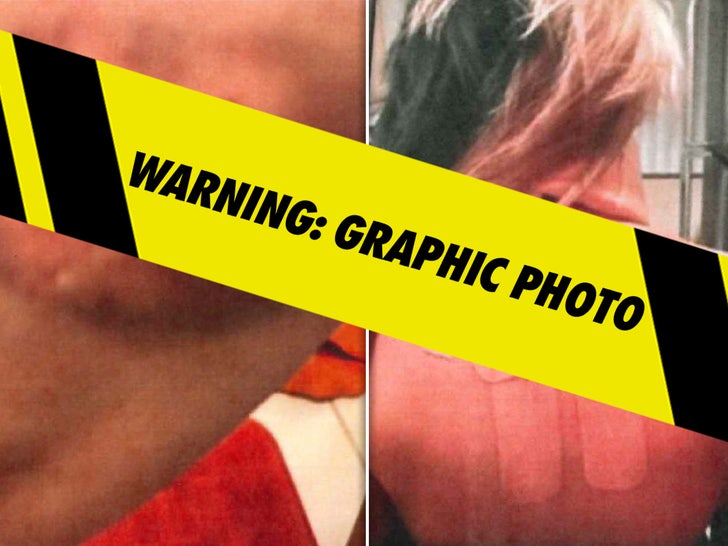 4eb187ef41fa42bf80d958bf73d5a894_md P Diddy Court Exhibits - Bryana Bongolan's Injuries
