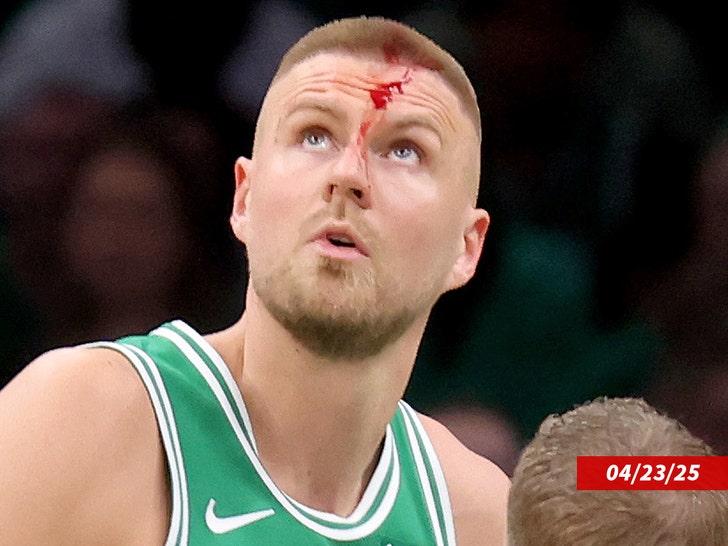 Kristap-Porzingis-blood-getty-1