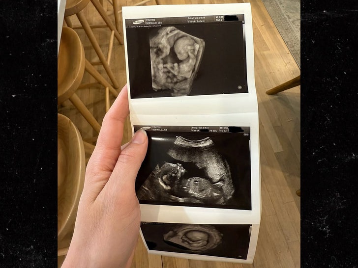 6cd40bf61c014a1d87f550a18df710fe_md Jessa Duggar Seewald ultrasound sub instagram .jpg