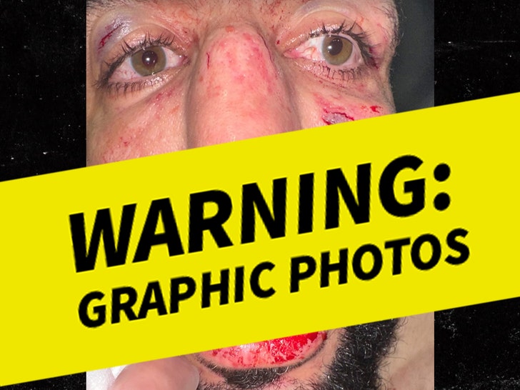 95c546cfe2974e72be639a4a4daac990_md Belal Muhammad's Injury