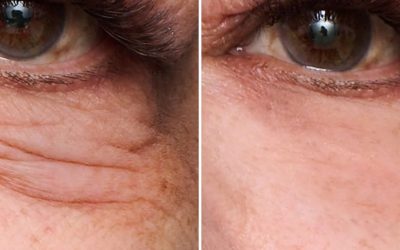 The Viral New Peter Thomas Roth Instant FIRMx Eye Temporary Eye Tightener Is Finally Back in Stock!