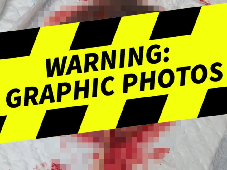a49800b4359747dd9b7f4c0a386efc59_md Calvin Harris' Wife Vick Hope's Placenta