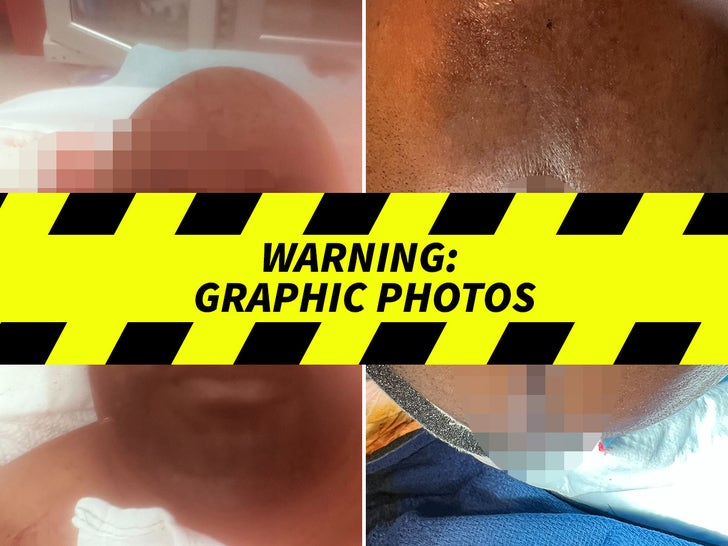 a7caf1646dbd48ebbb1f37a37988e27d_md Finesse2Tymes Shooting Victim Alleged Injuries