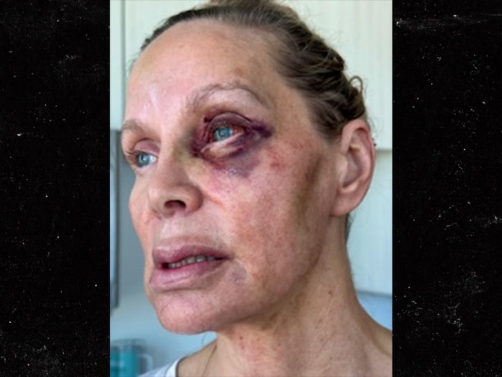 b178cdab37d2490ab62cce91ffbe9cf7_md-1 christina fulton weston cage black eye sub