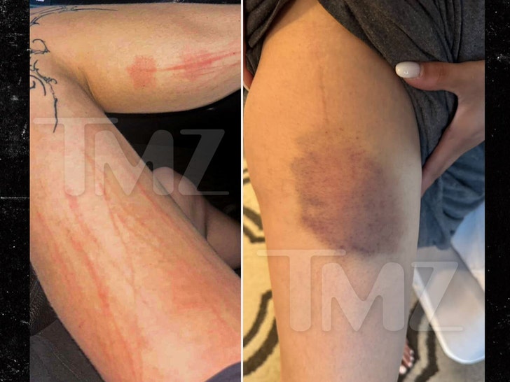 zak bagans injuries handout