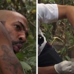 ‘Naked and Afraid’ Contestant Has Stitches Removed From Butt