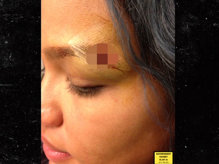 c74998eabe8347abb6d2013c998c9272_md Cassie Cut On Eyebrow
