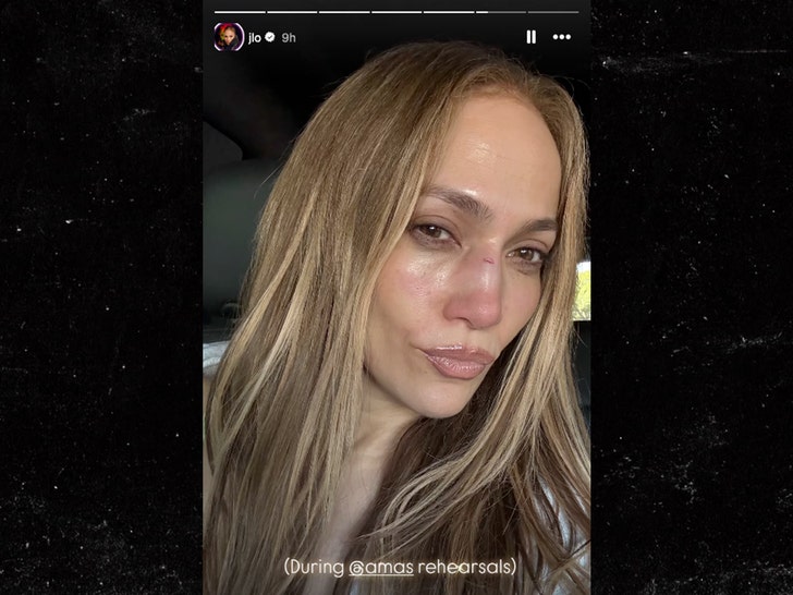 jennifer lopez ama rehearsal injury insta