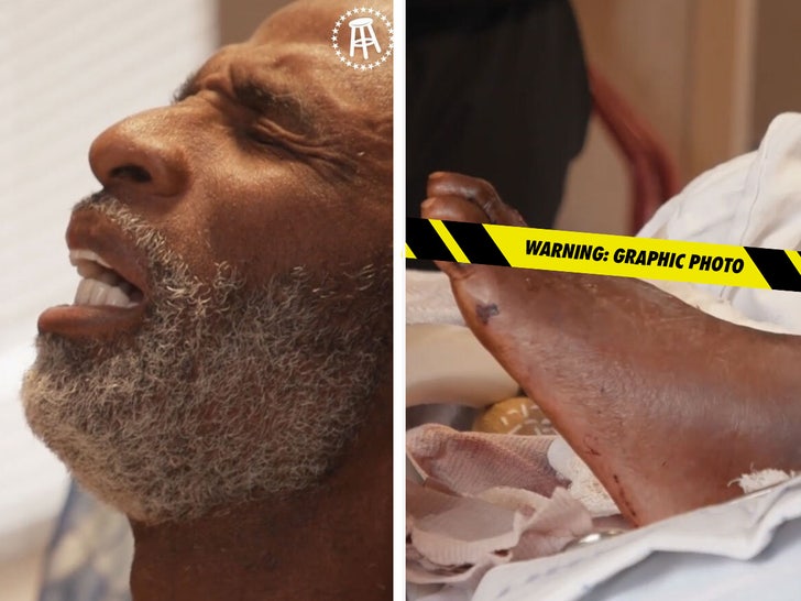 d670b7932e8d43feb5311418f70be989_md Deion Sanders' Toes Amputated