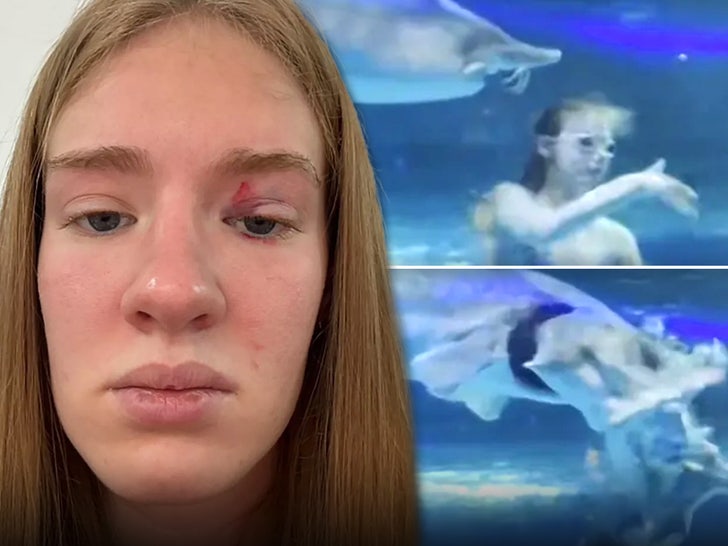 dea03a2ee39343e48ac6fd23ff969ee3_md mariia zelenina fish attack injury  NewsX-Joseph Golder main