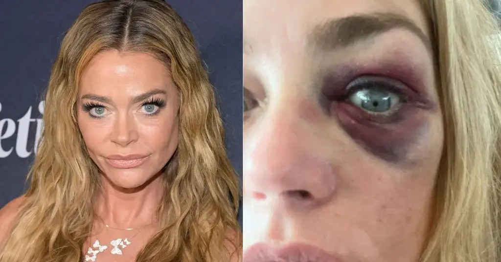 denise-richards-divorce-aaron-phypers-rhobh-spotlight-2-1757578628150-1760798109836 denise richards divorce aaron phypers rhobh spotlight