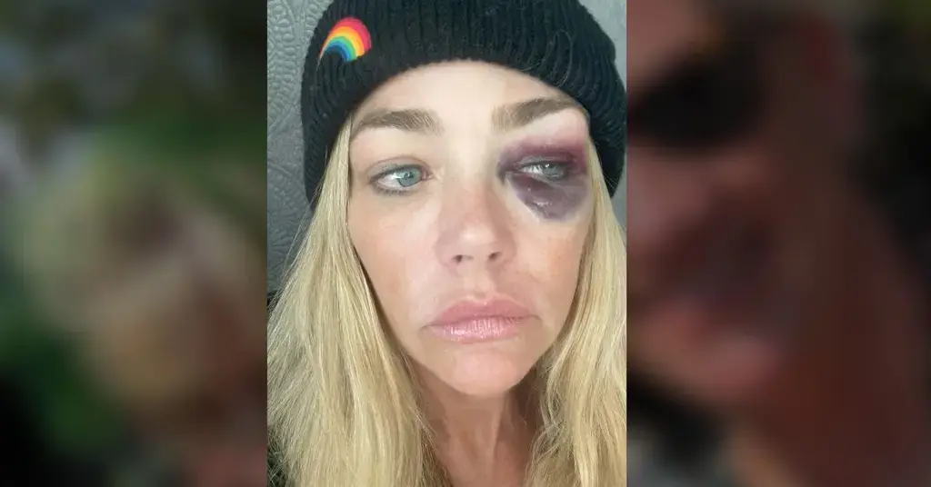 Photo of Denise Richards