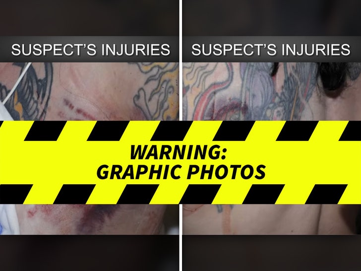 e1d69ca0437a4b18b9a0aa1ca6950d59_md Jillian Shriner’s Alleged Injuries -- GRAPHIC WARNING
