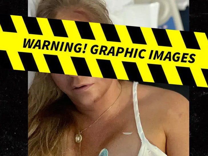 e833bc228ef2463dae47171f94de03eb_md-1 Virginia Giuffre Car Crash Injury