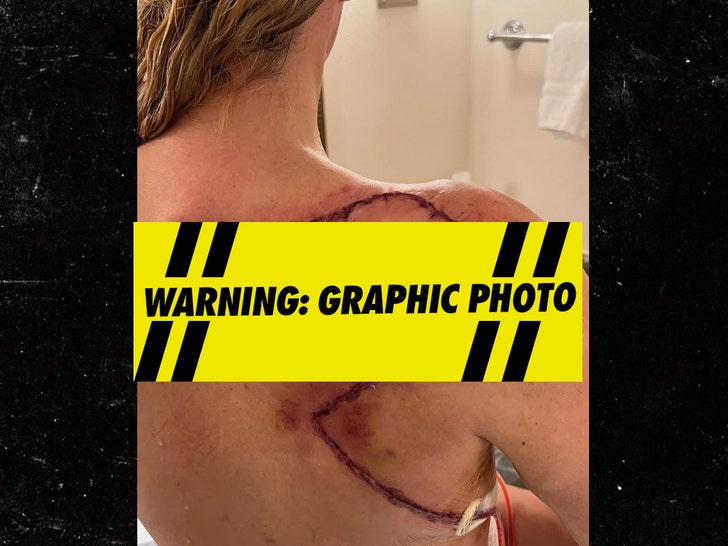 ea697214c99546faa26295358bc0ed3b_md Teddi Mellencamp Post Surgery
