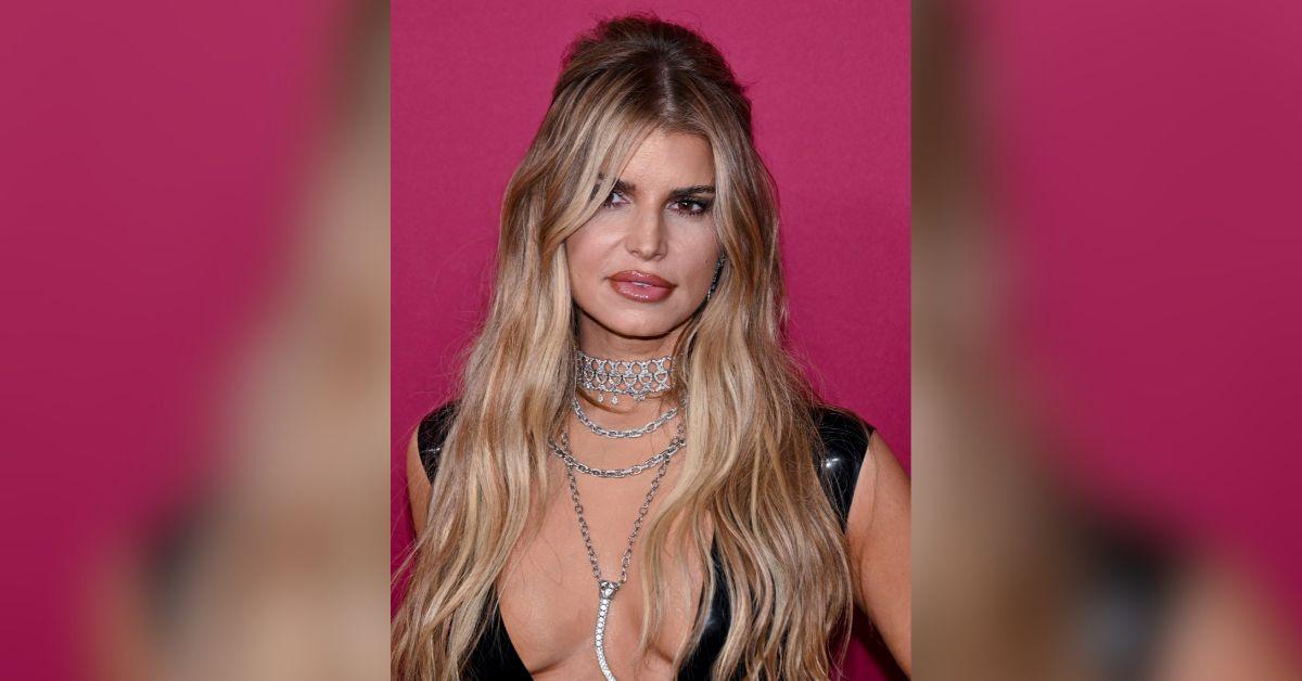 jessica-simpson-plastic-surgery-distaster-fillers-surgeon-speaks-1761346574766 Photo of Jessica Simpson