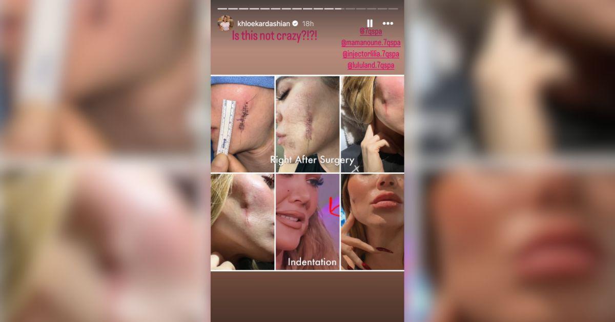 khloe-kardashian-cancer-1-1746463627467 khloe kardashian cancer