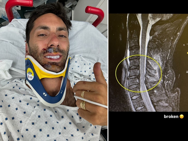 4f4e62989ddb4442876fb21371dc6729_md-1 nev shulman broken neck