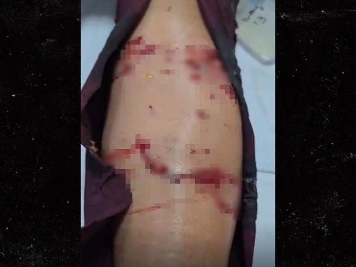 lady in malaysia gets attacked by otters 4