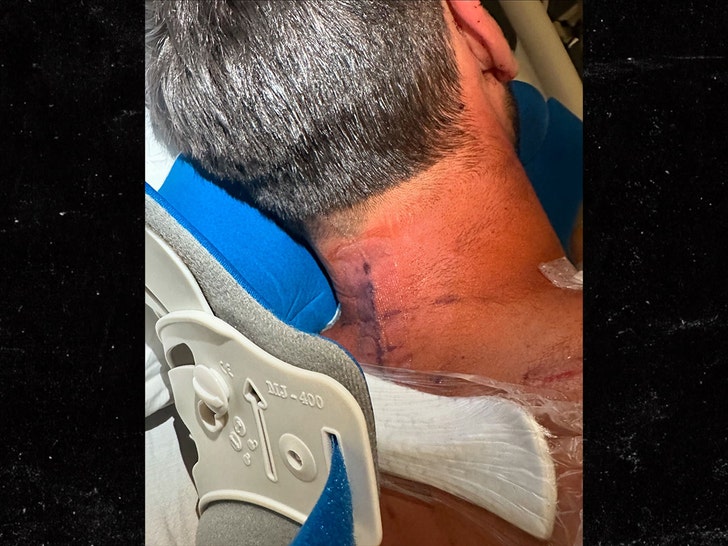 723b267c383f4801bf337963ff4aa3e6_md nev shulman broken neck