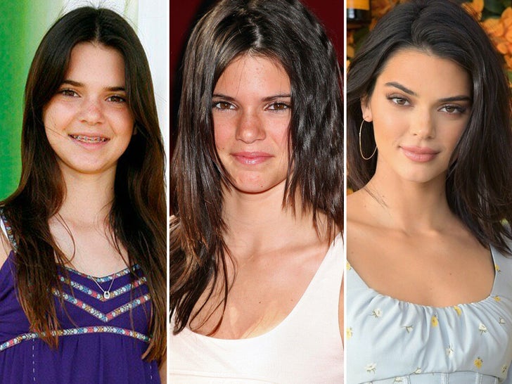 Kendall Jenner -- Through The Years