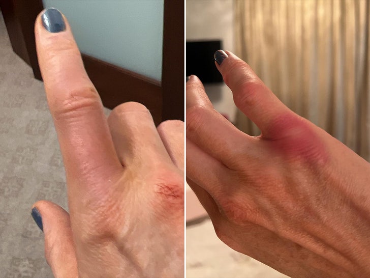 989d12e455004c31ae4dd095598d771c_md kate beckinsale injury