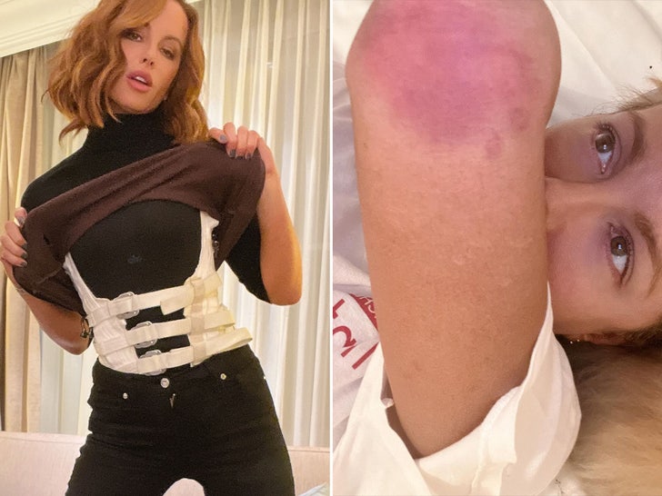 ab7e9e6d277340b79aece229dfcf1a0a_md kate beckinsale injury