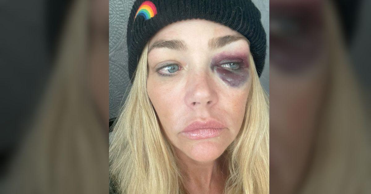 denise richards star power accusation aaron phypers arrest