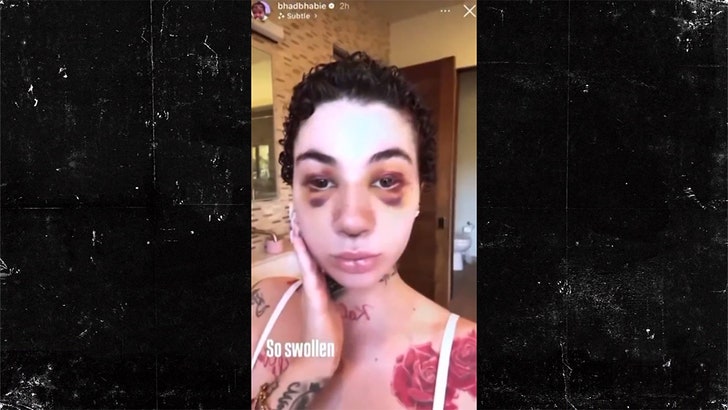 f176c9ee23514ef19e93104a4d46d4b4_md 012225_bhad_bhabie-kal