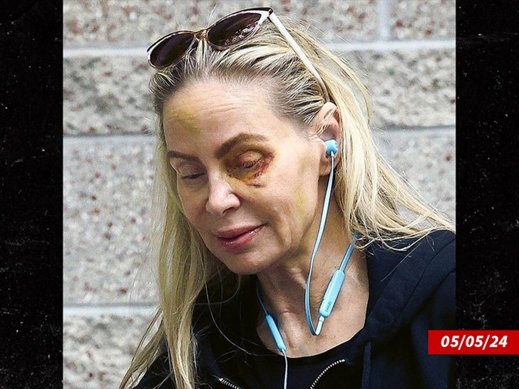 weston cage mother eye