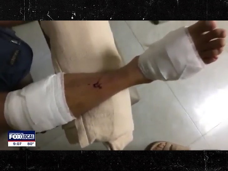 070824-shark-attack-husband-leg-primary