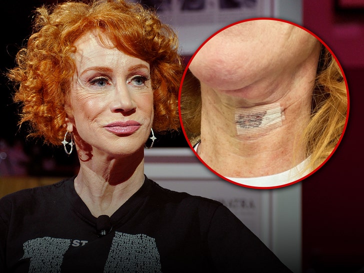 60680e835f784d3597dab812a0633c12_md kathy griffin vocal cord