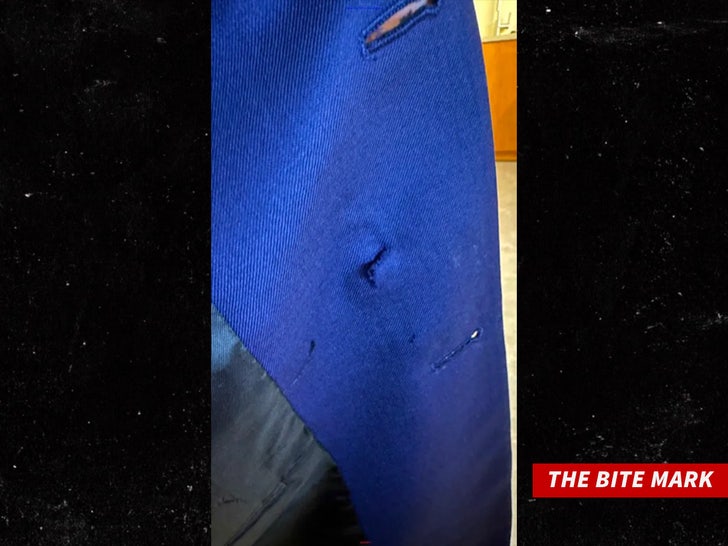 6a39d471b37142718f2fd2c1a14adad1_md the bite mark sub