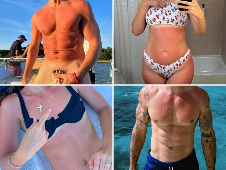 Celebrity Sunburns -- Guess Who!