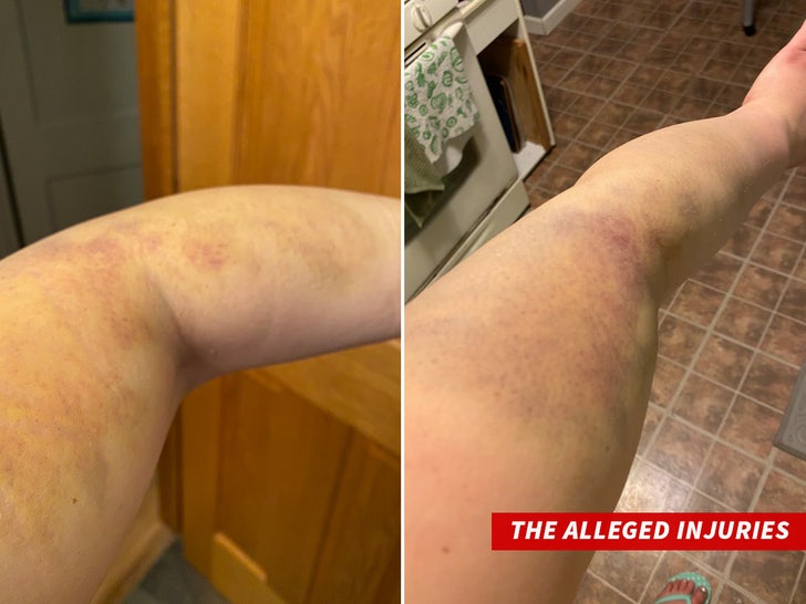 acdd0a3b3377450e8bf596593ed8aef7_md Derek Chauvin The Alleged Injuries